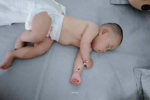 湘阴宝宝头上长痱子